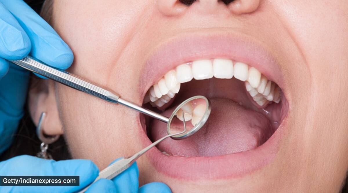 ¿Qué son los «dientes de pavo», la última tendencia contra la que advierten los dentistas?