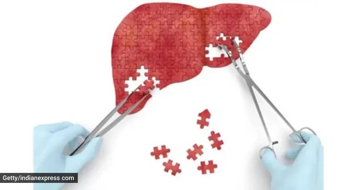 Día Mundial de la Hepatitis 2022: ¿Qué es la hepatitis alcohólica y es reversible?