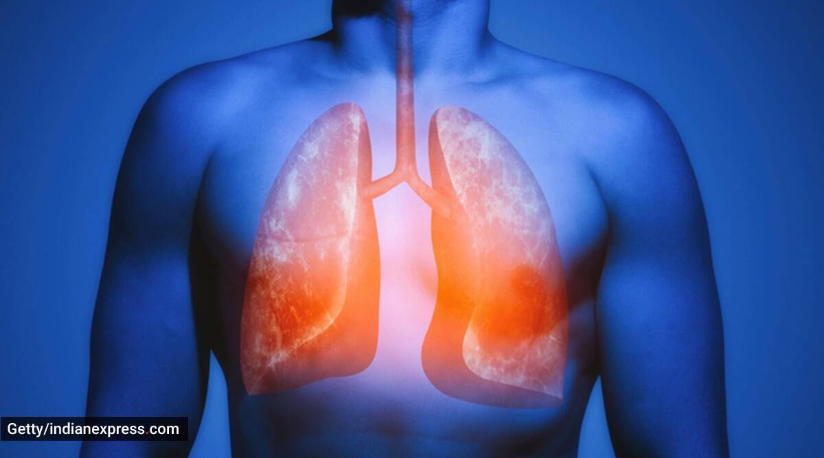 ¿Cuál es el papel de la cirugía en los pacientes con complicaciones de Covid-19? Un médico explica ¿Cuál es el papel de la cirugía en los pacientes con complicaciones de Covid-19? Un médico explica