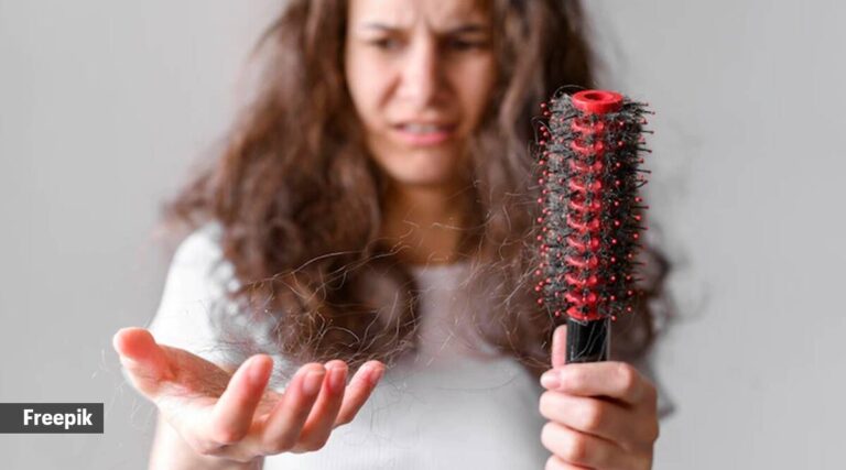 Experto comparte cinco consejos eficaces para controlar la caída del cabello debida al síndrome de ovario poliquístico